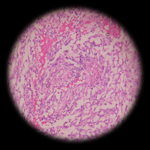 Picture of Histopathology