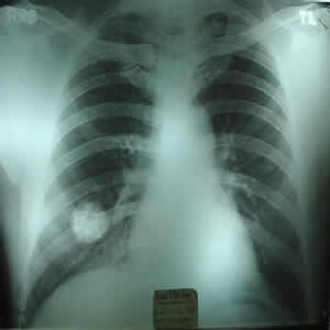 X-ray dated 30.07.2000