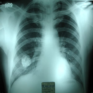 X-ray dated 28.04.2001