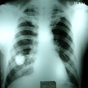 X-ray dated 22.09.2002