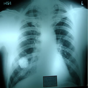 X-ray dated 22.01.2004