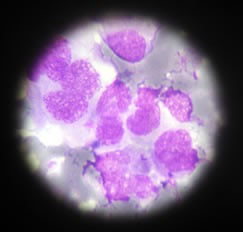 Picture of Histopathology, dated 24.11.1994