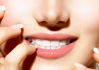 Причины потемнения зубов