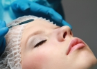 Хирургическая подтяжка кожи лица