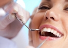 Виды и основные методы профессионального отбеливания зубов