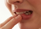 Лечение рака слизистой рта