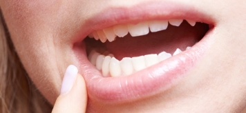 Кто лечит стоматит: стоматолог или гастроэнтеролог?