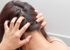 Демодекоз головы – причины, диагностика, лечение