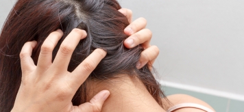 Демодекоз головы – причины, диагностика, лечение