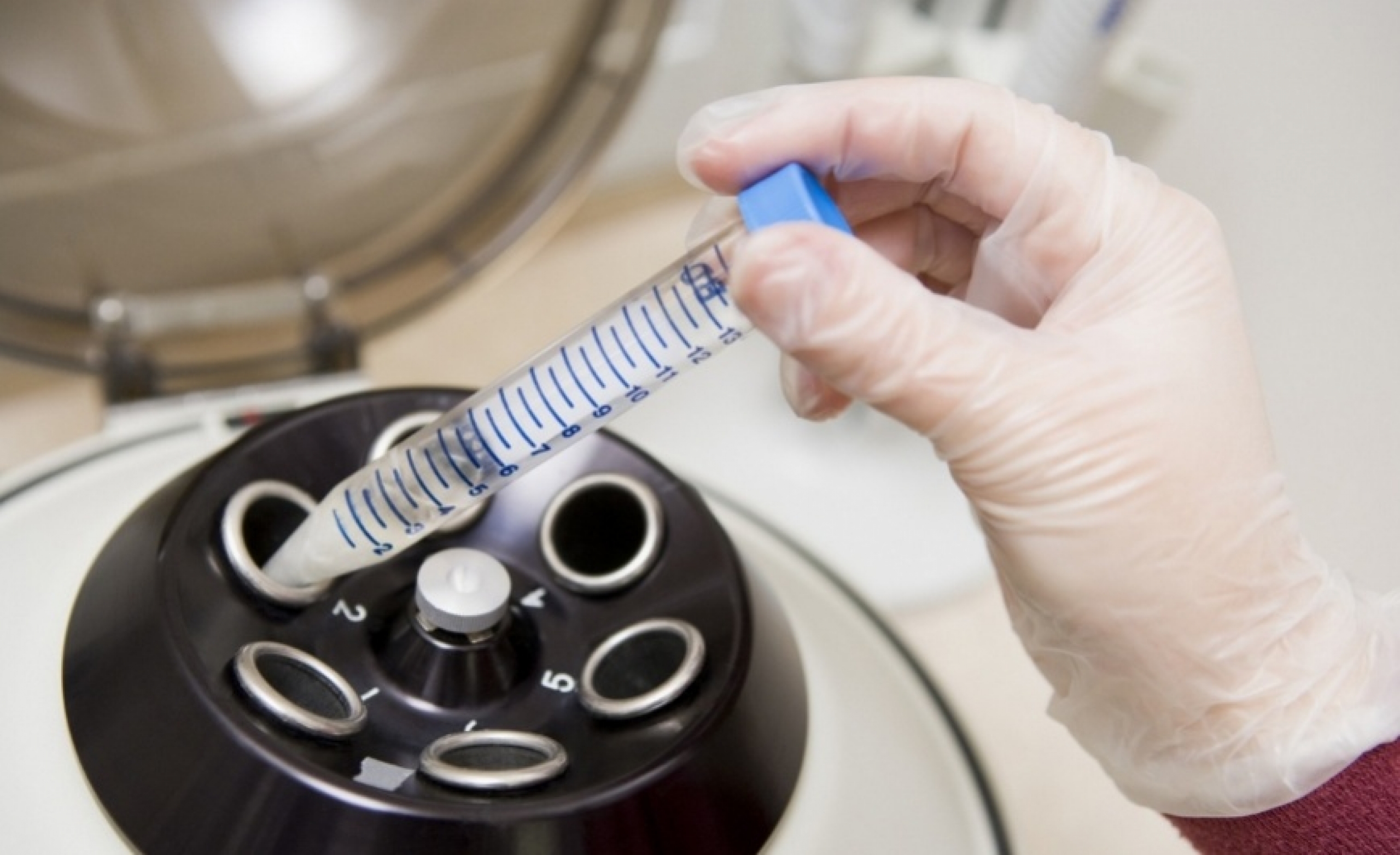 Методика измерения качества спермы