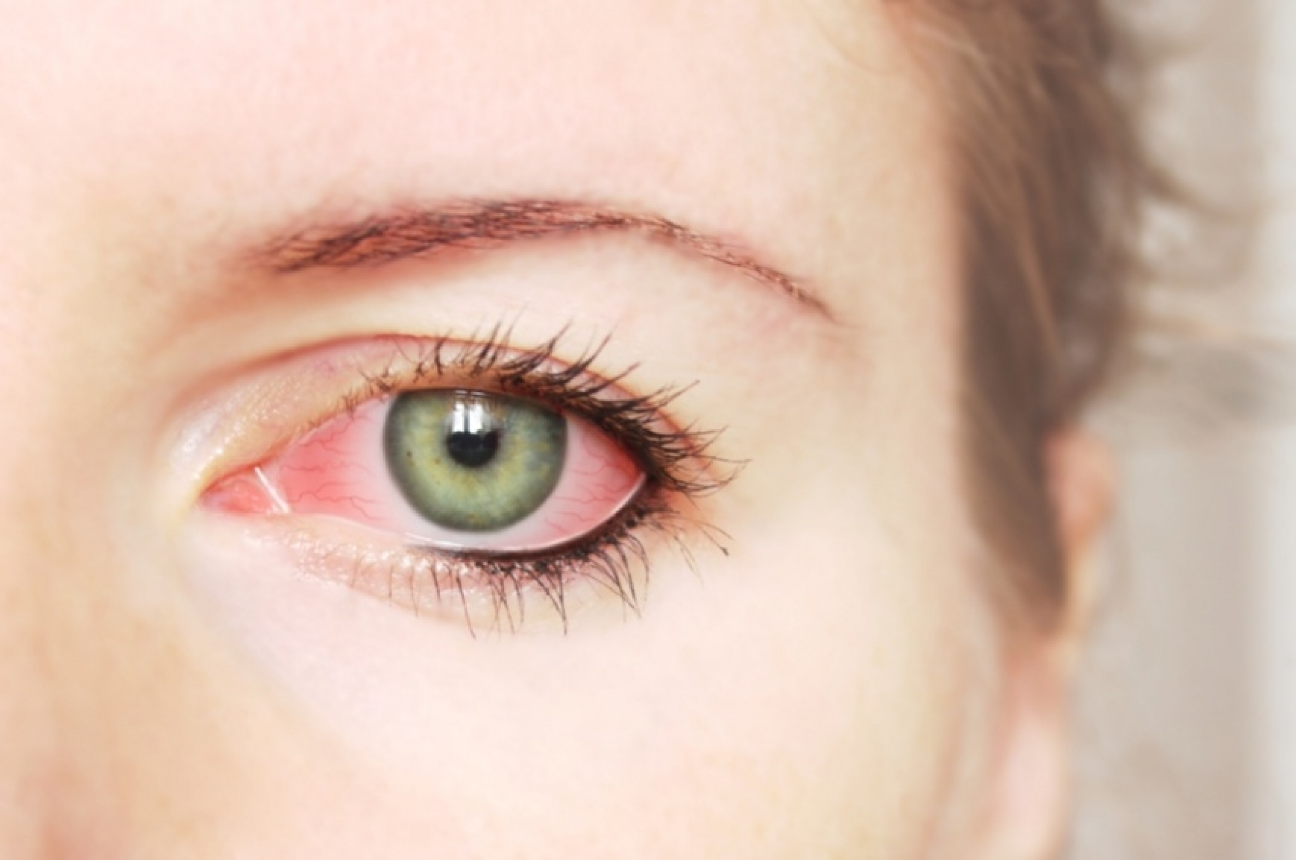 Красные глаза: снимаем усталость органов зрения