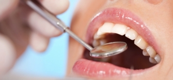 Виды зубных пломб