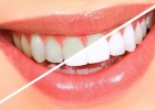 Чем отбелить зубы в домашних условиях