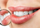 Здоровье зубов: от каких продуктов лучше отказаться