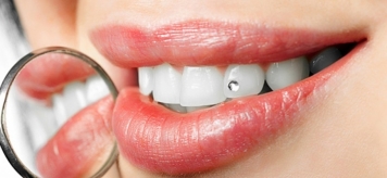 Здоровье зубов: от каких продуктов лучше отказаться