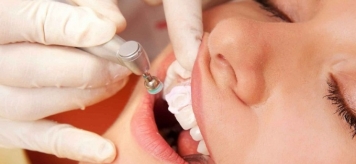 Профессиональные способы удаления зубного камня