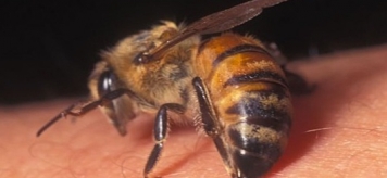 Сладко-опасная апитерапия: что такое лечение пчелами