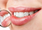 Украшения на зубах как повод привлечь внимание окружающих