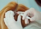 Плазмотерапия волос: что это такое