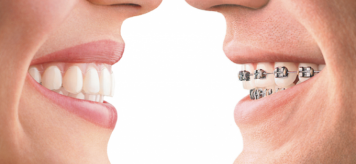 Этапы развития ортодонтии