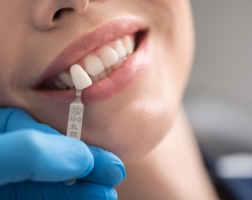 Протезирование зубов: разновидности, показания, возможные осложнения
