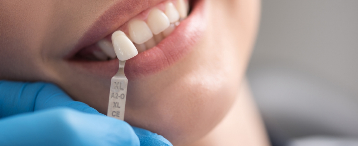 Протезирование зубов: разновидности, показания, возможные осложнения