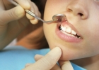Откуда у взрослых молочные зубы?