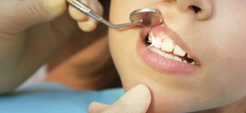 Откуда у взрослых молочные зубы?