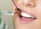 Киста на корне зуба: лечить или резать?