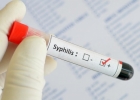 Диагностика и лечение сифилиса