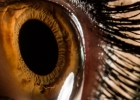 Иридодиагностика: распознаем болезни по глазам
