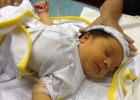Как относиться к желтухе у новорожденных?