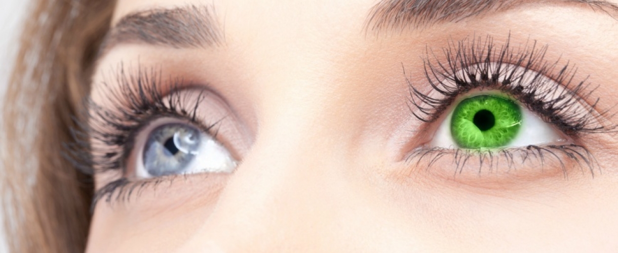 Что такое гетерохромия глаз?