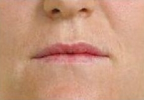 Тонкие губы фото 2