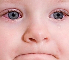 Аллергический конъюнктивит у детей фото 2