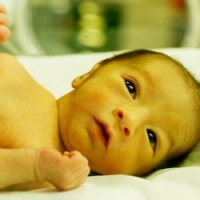 Желтуха у новорожденных фото 1