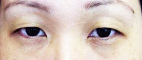 Азиатский разрез глаз фото 2