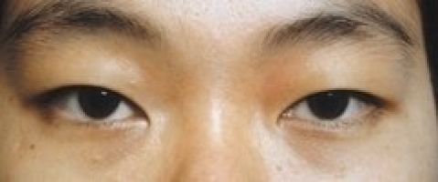 Азиатский разрез глаз фото 1