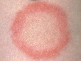 Заболевания кожи фото 2