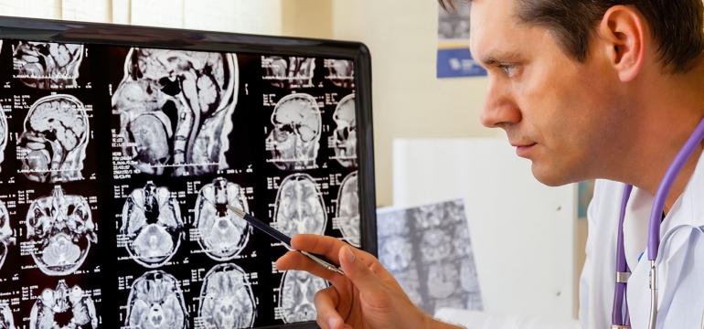 Стоимость МРТ головного мозга