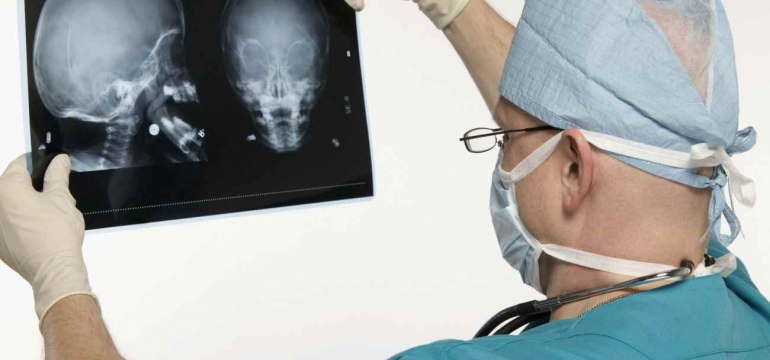 Противопоказания к проведению рентгена черепа