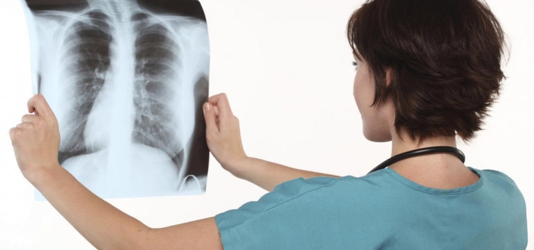 Рентген грудной клетки: цена