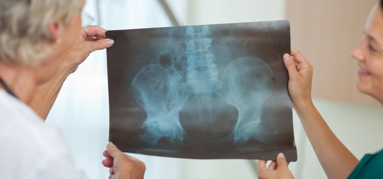 Рентген тазобедренного сустава в Москве