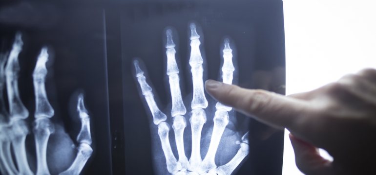 Рентген пальца в Москве