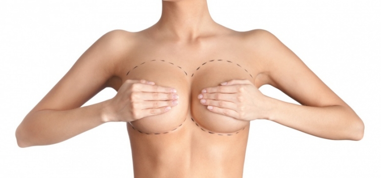 Удаление/замена грудных имплантатов