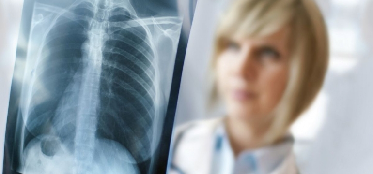 Рентген грудного отдела позвоночника: что показывает