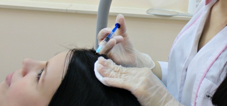 Мезотерапия волос в Москве